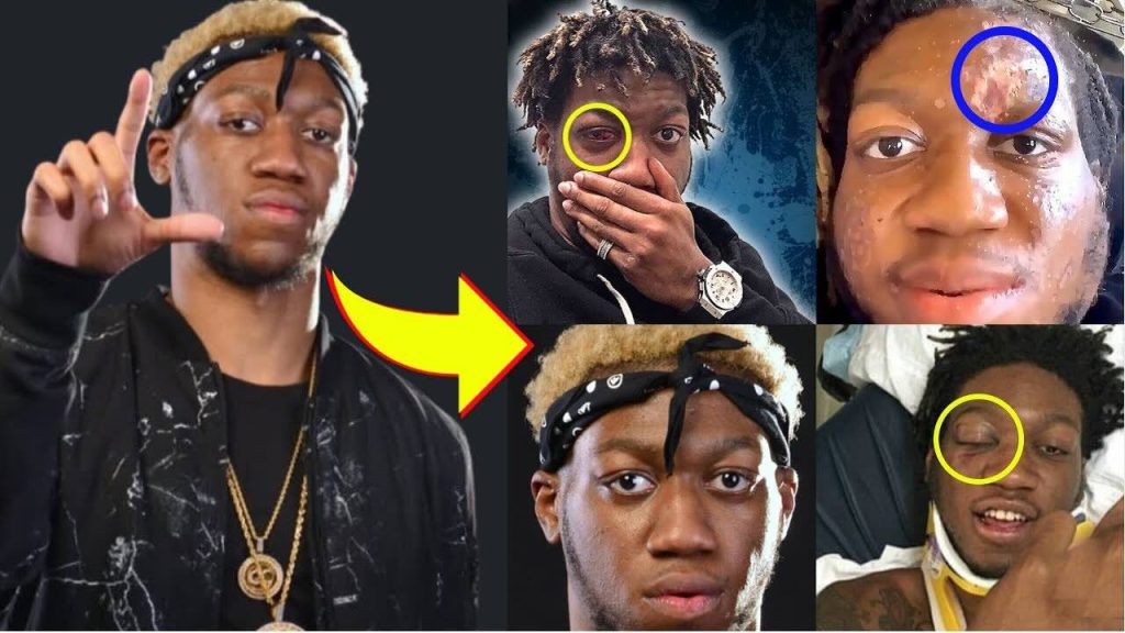 og maco